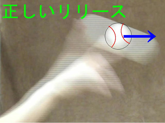 イップス治療　イップス克服　イップス改善　イップス病院