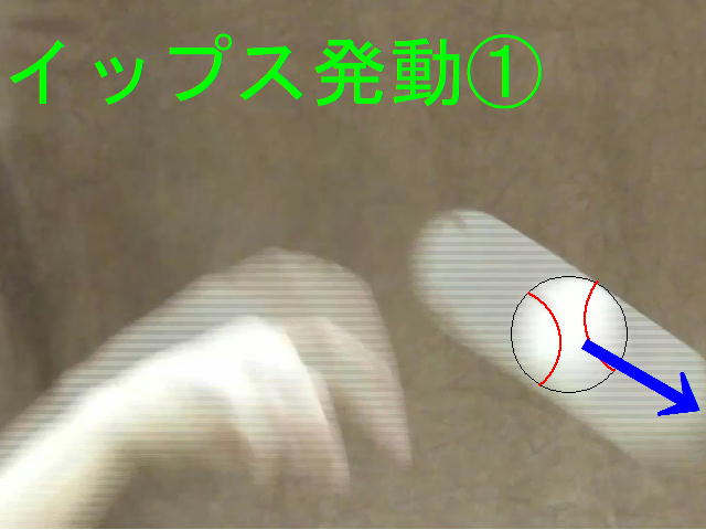 イップス治療　イップス克服　イップス改善　イップス病院