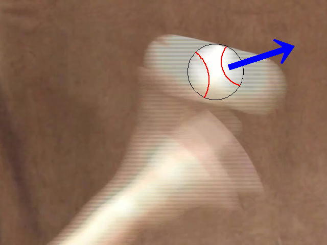 イップス治療　イップス克服　イップス改善　イップス病院