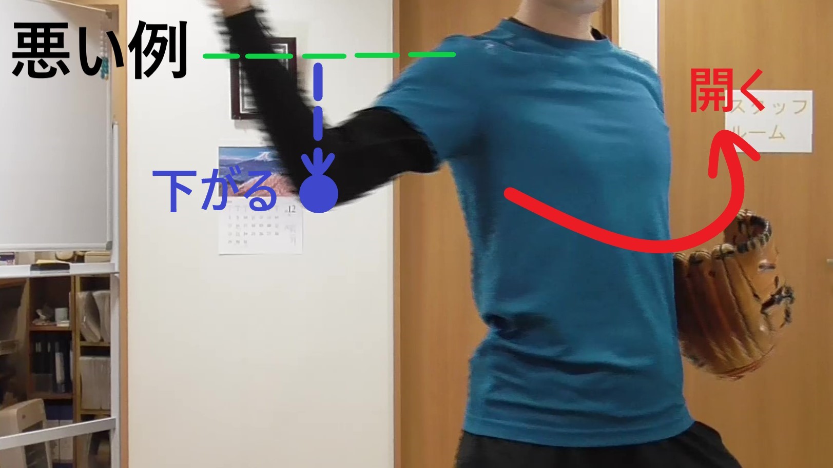 イップス治療　イップス克服　イップス改善　イップス病院