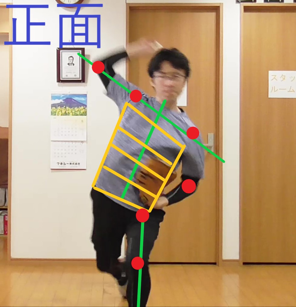 イップスDVD治療