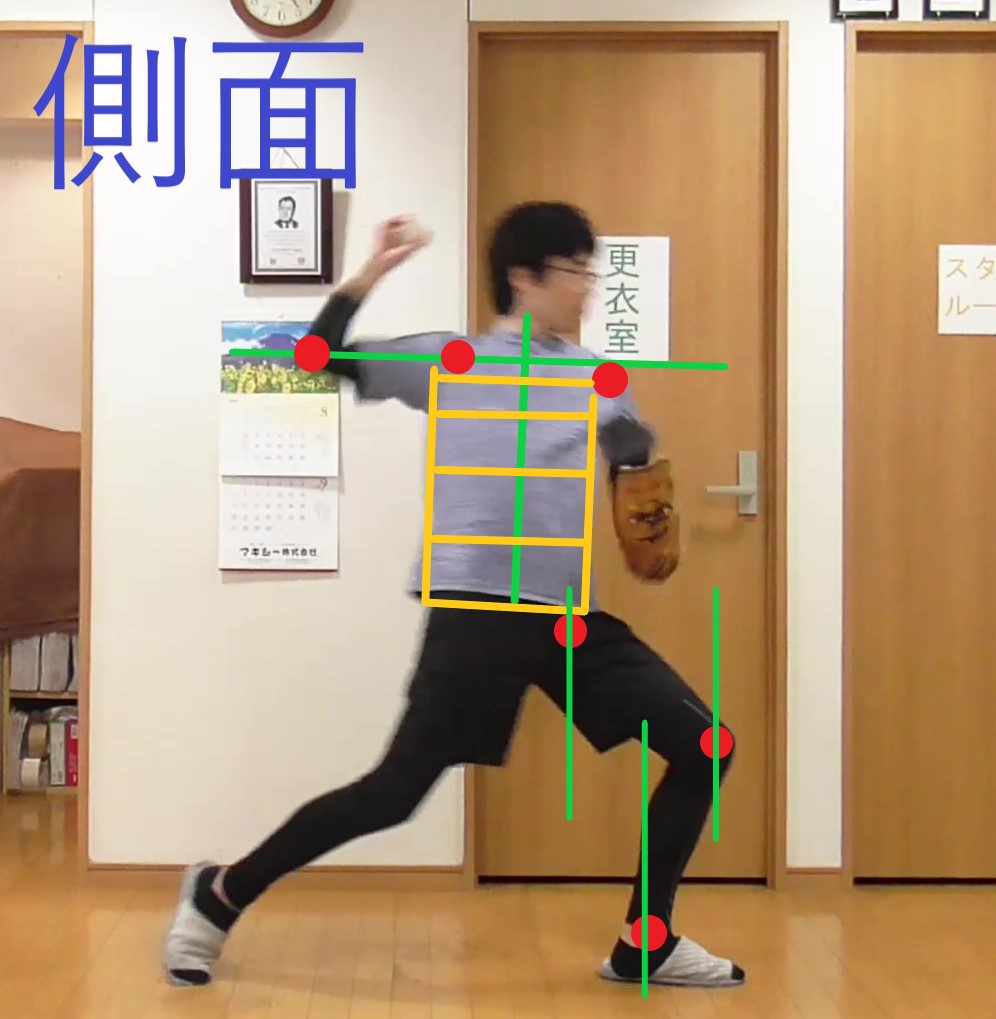 イップスDVD治療