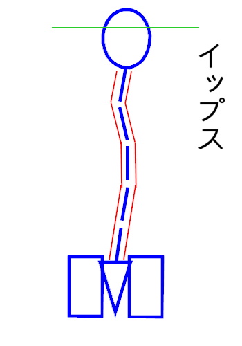 イップス治療　イップス克服　イップス改善　イップス病院