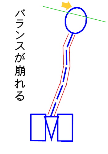 イップス治療　イップス克服　イップス改善　イップス病院