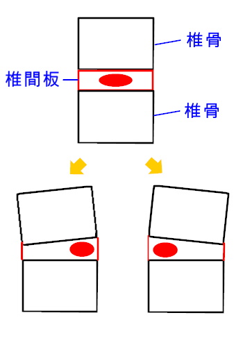 イップス治療　イップス克服　イップス改善　イップス病院