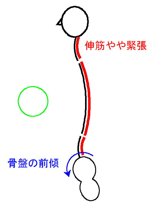 イップス治療　イップス克服　イップス改善　イップス病院