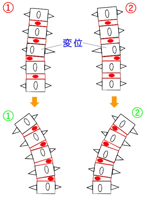 イップス治療　イップス克服　イップス改善　イップス病院