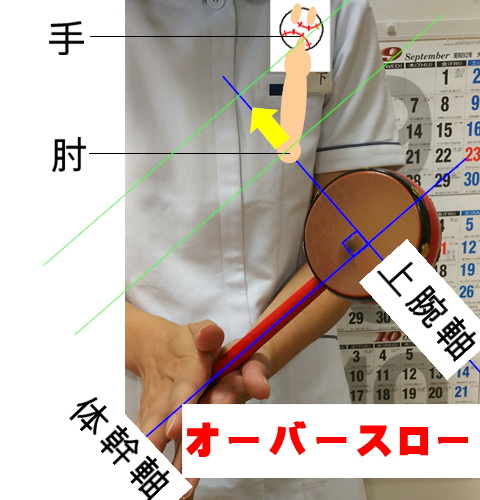 イップス治療　イップス克服　イップス改善　イップス病院