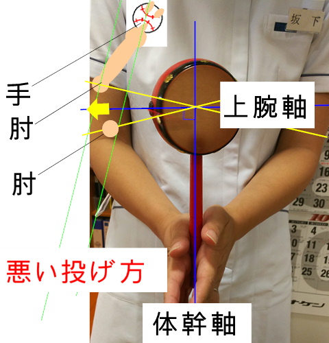 イップス治療　イップス克服　イップス改善　イップス病院